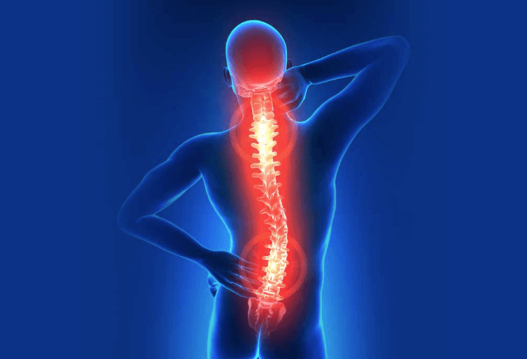 Spinal Stenoz Nedir?