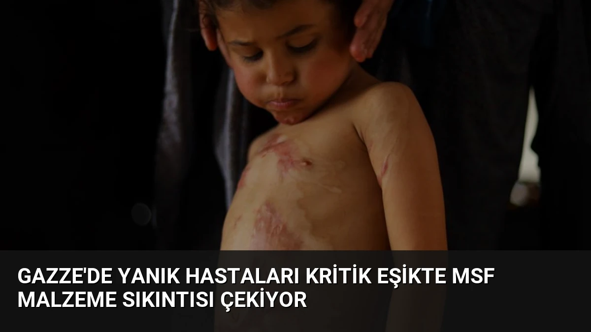 Gazze’de Yanık Hastaları Kritik Eşikte MSF Malzeme Sıkıntısı Çekiyor