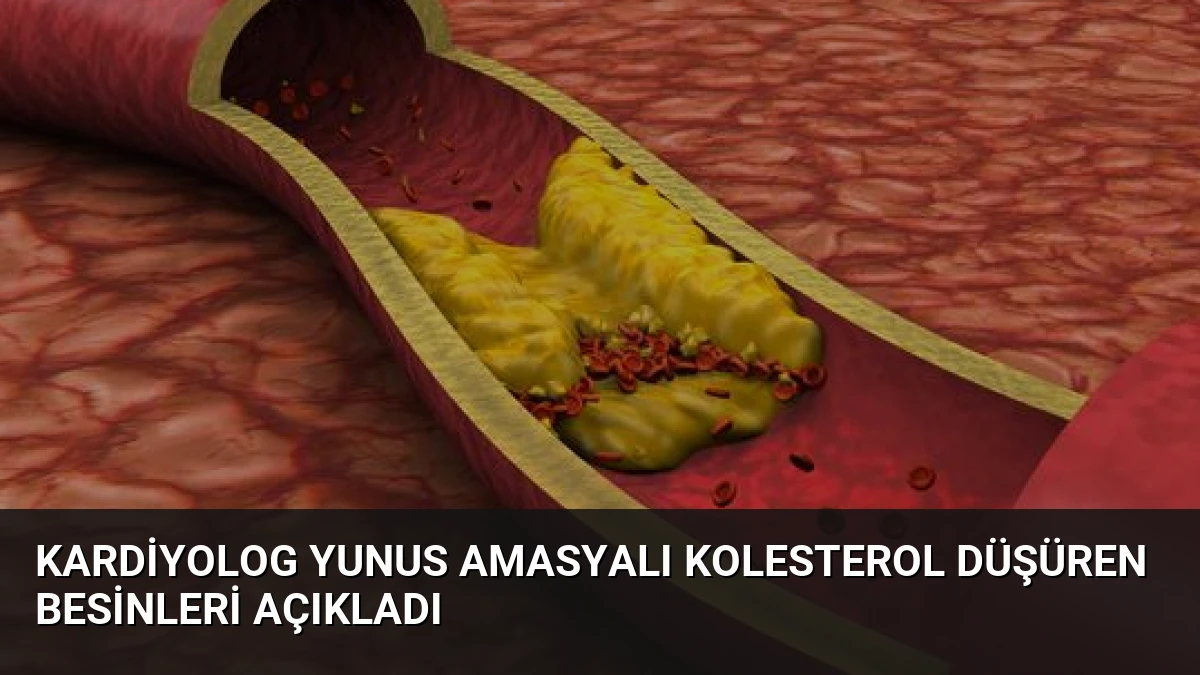 Kardiyolog Yunus Amasyalı Kolesterol Düşüren Besinleri Açıkladı