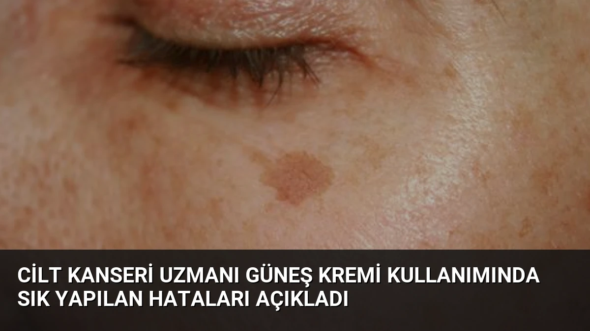 Cilt Kanseri Uzmanı Güneş Kremi Kullanımında Sık Yapılan Hataları Açıkladı